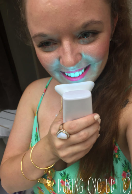 How I brightened my smile quickly and easily - Luster Premium White Review