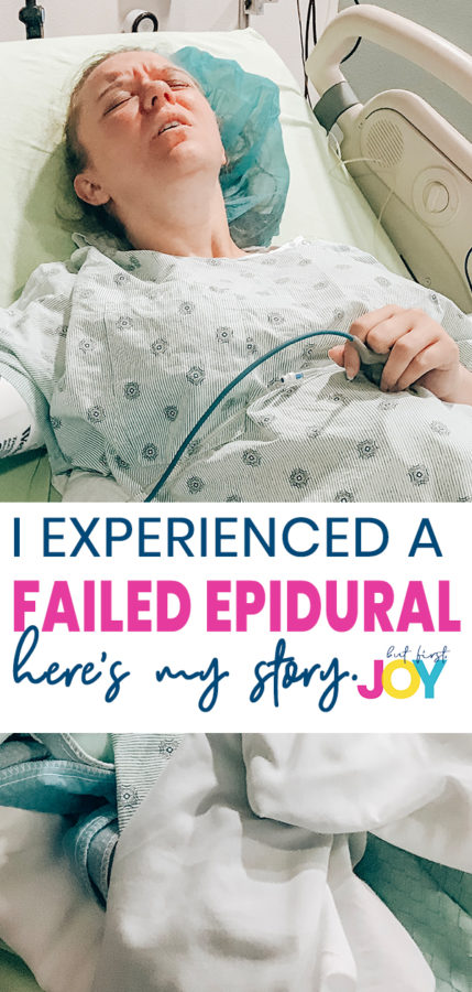 Failed Epidural Story experience