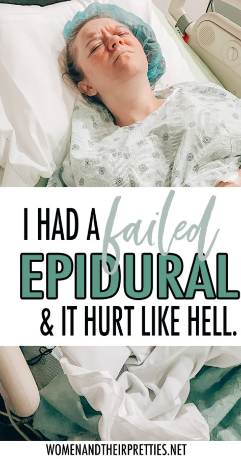 http://https://butfirstjoy.com/failed-epidural-childbirth/