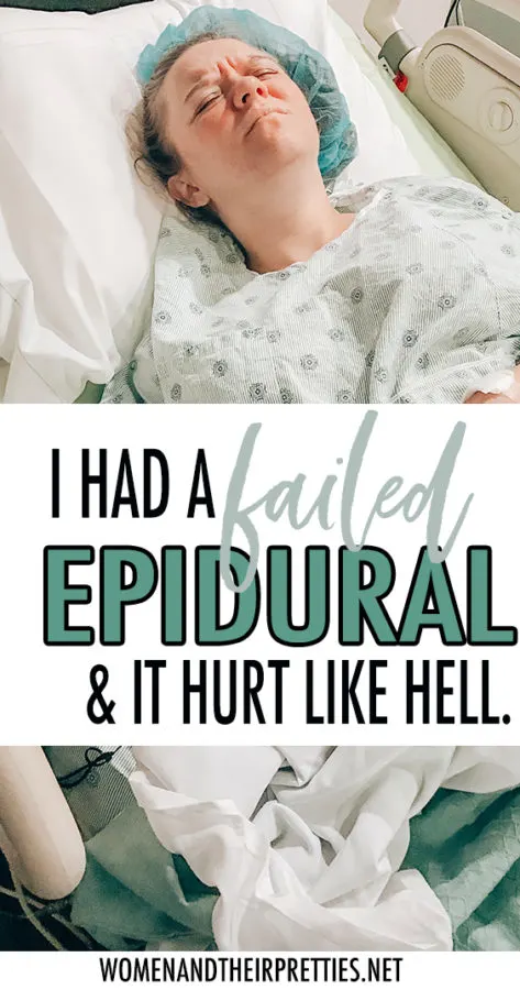 http://https://butfirstjoy.com/failed-epidural-childbirth/